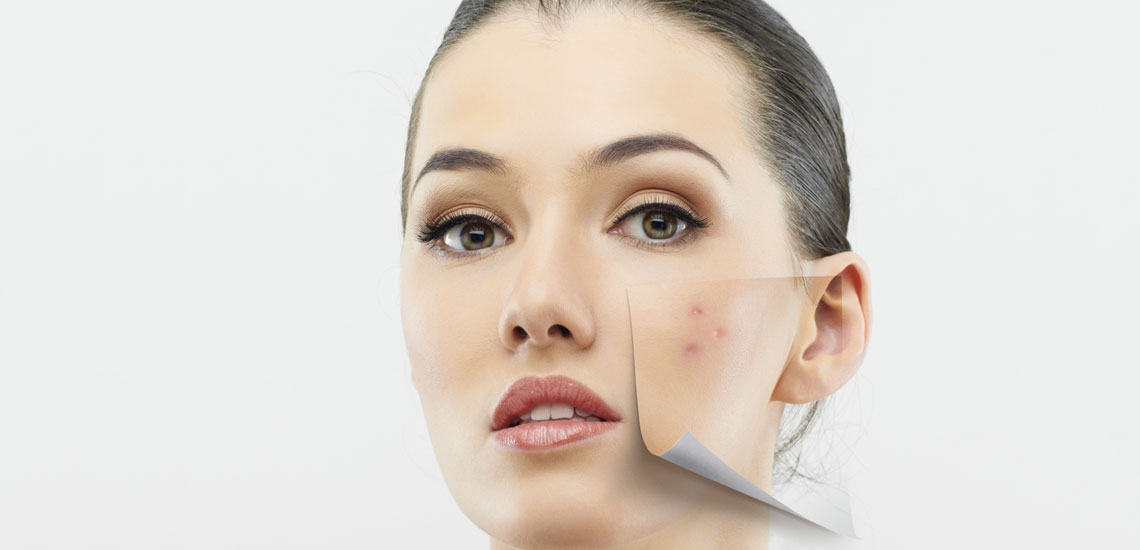 درمان لک صورت با ۱۰ ماسک موثر خانگی