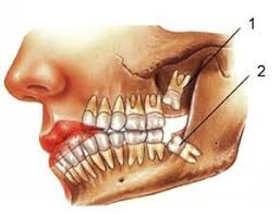 رابطه دندان، الفبا و عقل