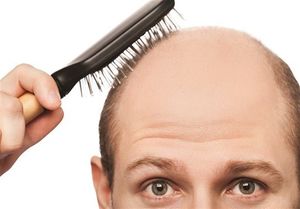 روشی برای جلوگیری از ریزش موی سر