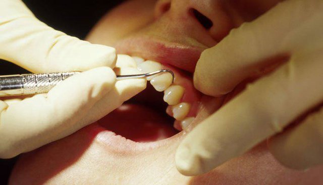 چند توصیه ساده برای درمان حساسیت دندانی