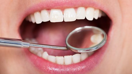 دندان هایتان را با روش های سالم سفید کنید