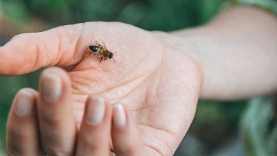 مراقبت‌ های پزشکی پس از نیش زنبور