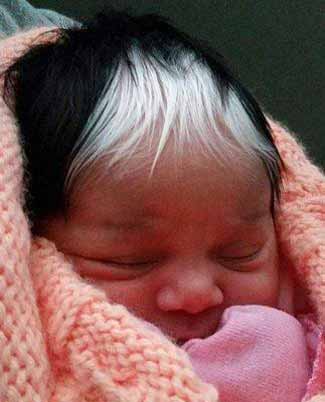 تولد یک نوزاد با موهای سفید!+عکس
