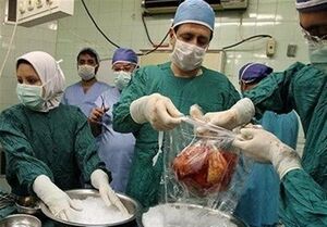 مرگ ۵۰۰۰ ایرانی در سال بر اثر بیماری‌های کبدی