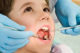 علت افزایش پوسیدگی دندان ایرانی‌ها