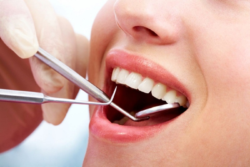 مصرف زیاد فلوراید و خمیردندان علت ایجاد لکه بر روی مینای دندان