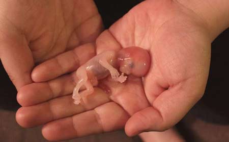 تبلیغات آزادانه سقط جنین در فضای مجازی! +عکس