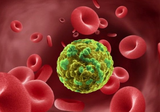 مهار سلول‌های سرطانی با «ویتامین دی»