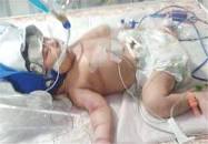 ماجرای مرگ نوزاد در یک بیمارستان در یاسوج