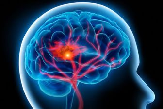 عفونت مغز از چیست و چه علائمی دارد؟