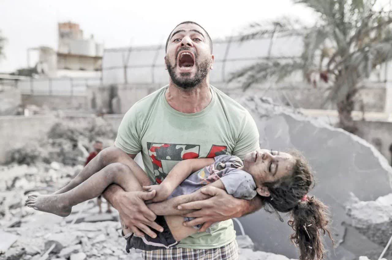 وضعیت این روزهای غزه
