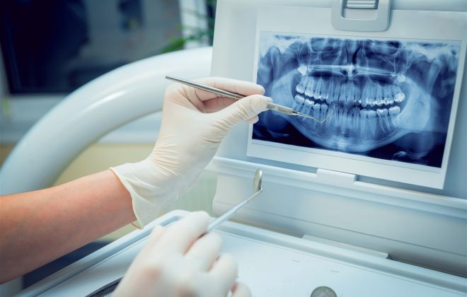 ارائه خدمات رایگان دندانپزشکی در رشت